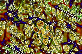 AUTISMO, TROPPE O POCHE CONNESSIONI NEL CERVELLO